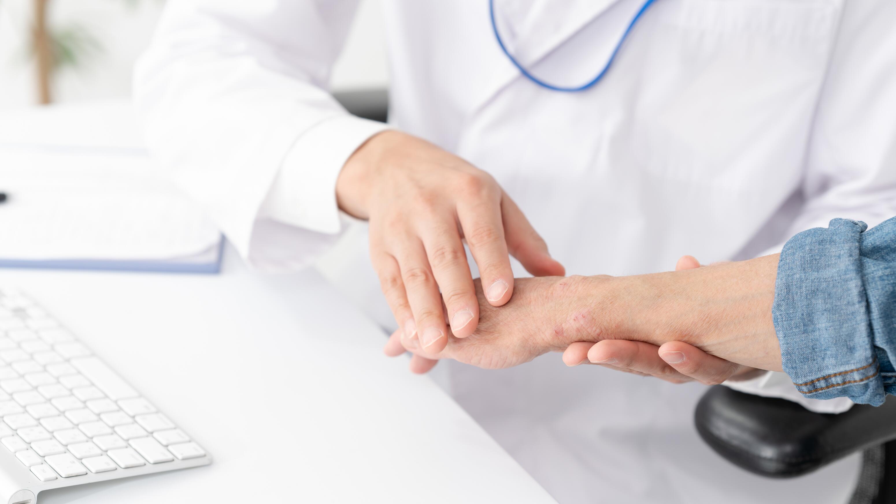 diagnostiquer l’eczéma